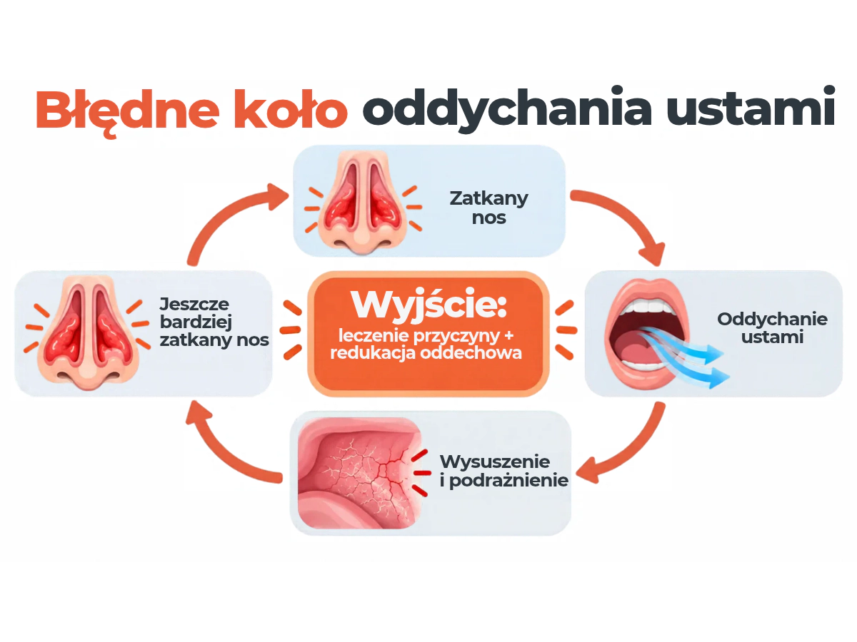 Błędne koło: zatkany nos, oddychanie ustami, wysuszenie i podrażnienie, jeszcze bardziej zatkany nos